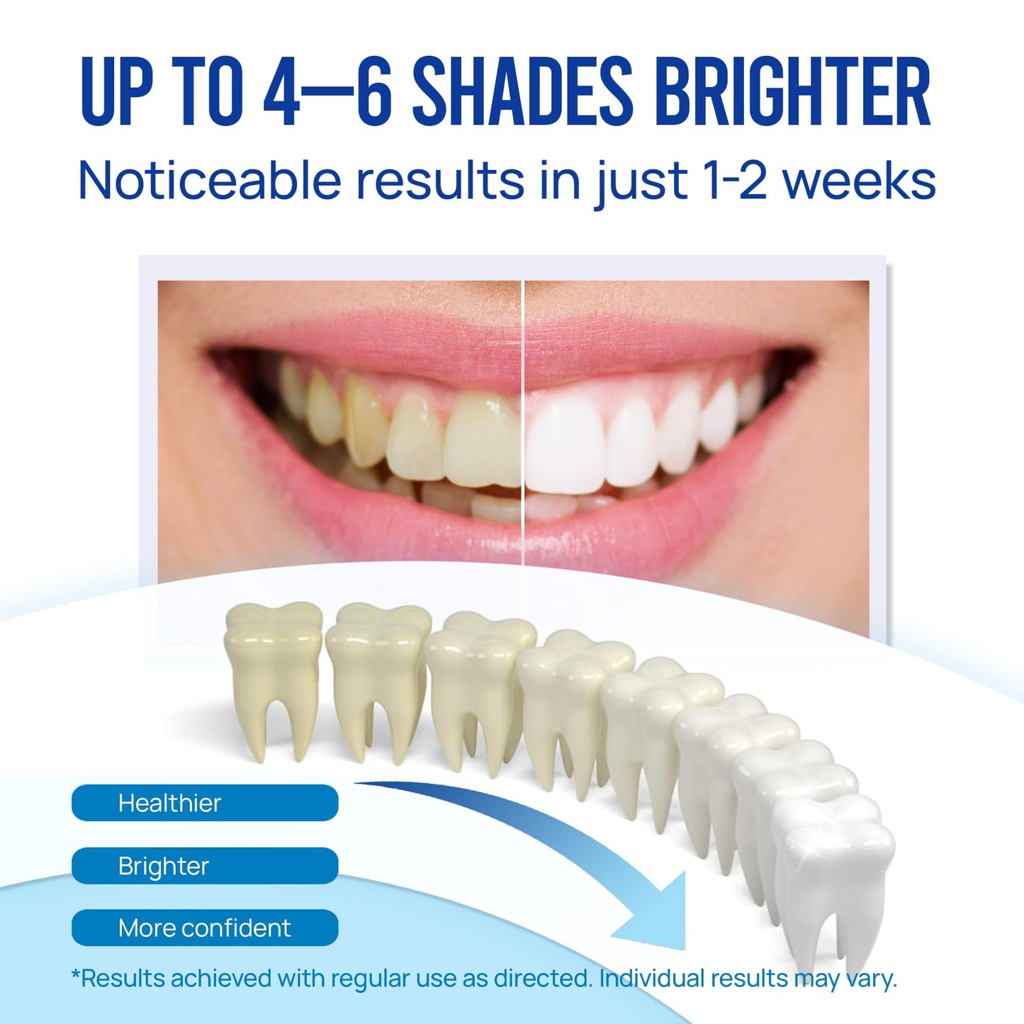 Teeth Whitening Pen Gel Kit: 35% Carbamide Peroxide Gel for Stain Removal - No Sensitivity with Remineralizing Pen for a Brighter Whiter Smile Mint (5 Pack)